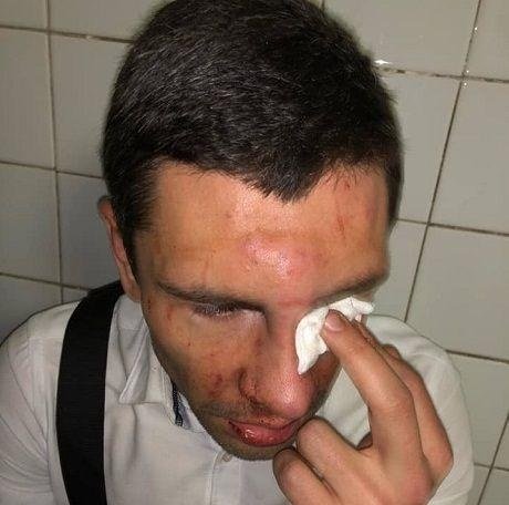 В Киеве избили соратника Ляшко