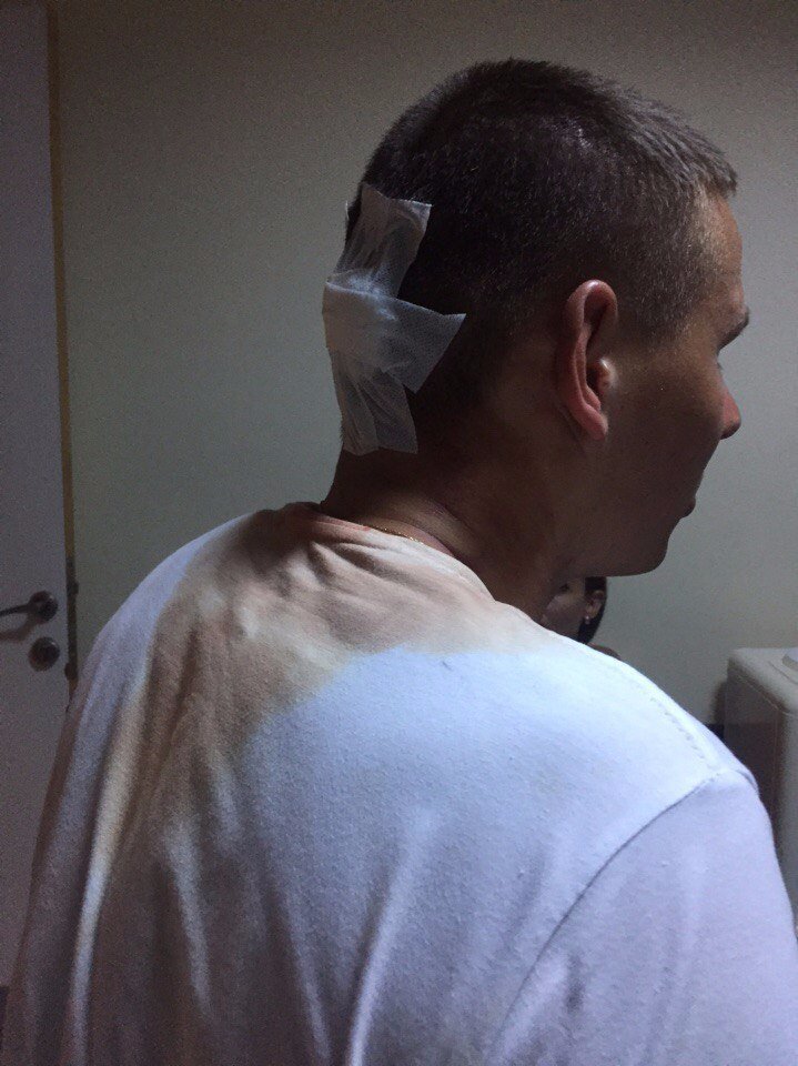 Персонал турецкого отеля жестоко избил пьяных российских туристов. Видео!