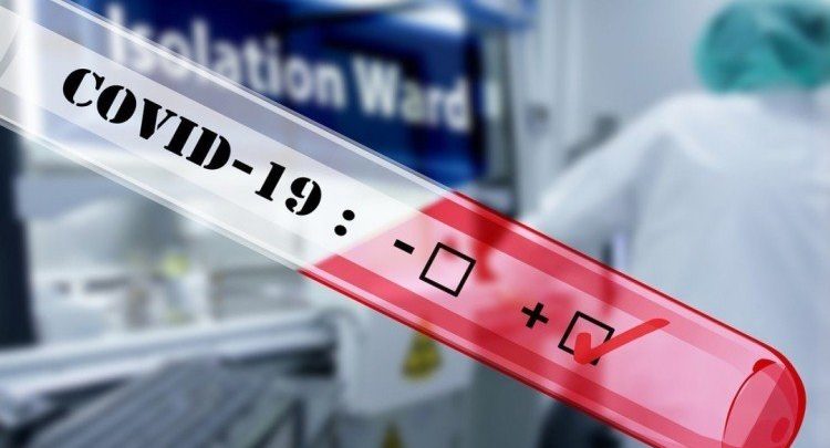 801 инфицированных больных в Киеве. Зафиксировали еще 31 случай коронавируса, в частности у 4 медиков