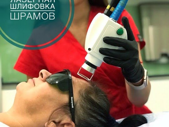 Лазерное удаление рубцов и шрамов на лице